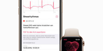 Apple watch