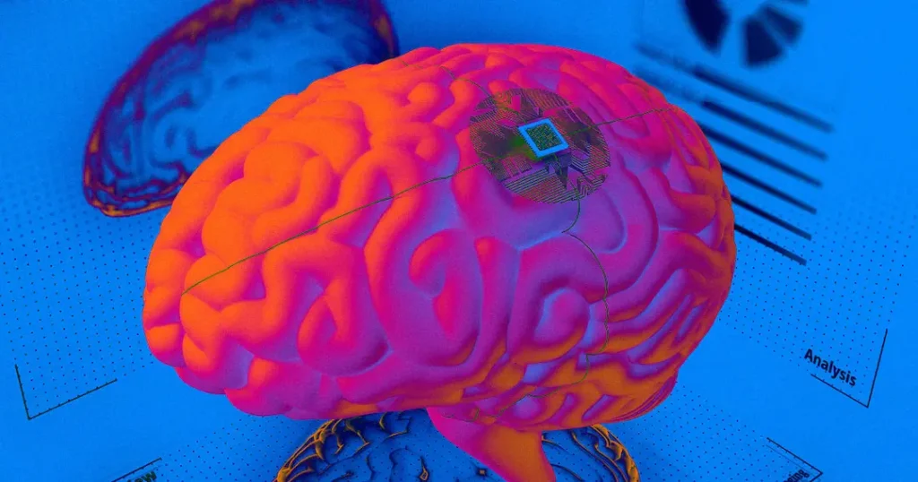 yeni beyin implantı