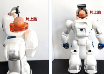 kök hüceyrələrindən beyinə