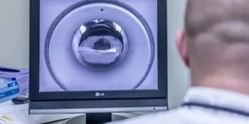 ChatGPT beyin şişlərinin diaqnostikasında radioloqları qabaqlayır!