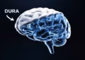Elon Neuralink